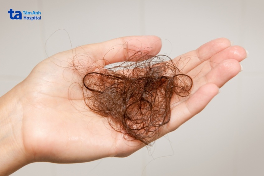 tình trạng rụng tóc nhiều