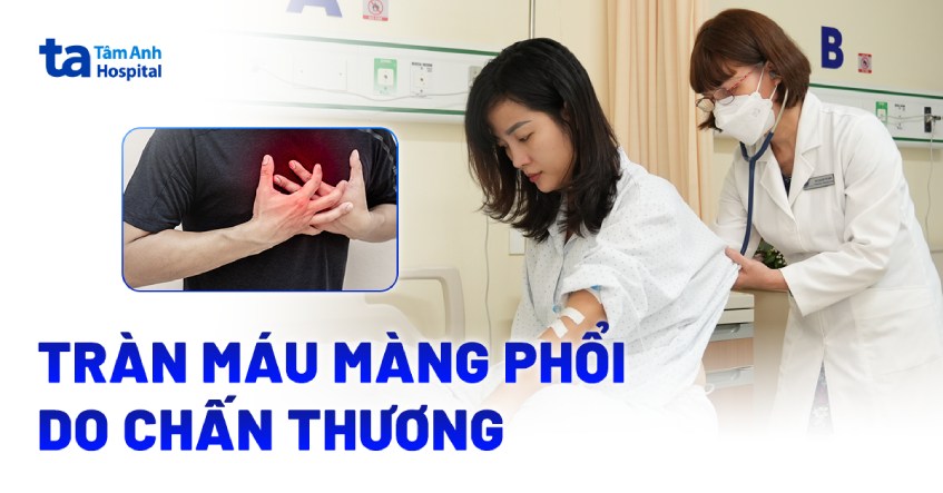 Tràn máu màng phổi do chấn thương nên tìm hiểu chi tiết