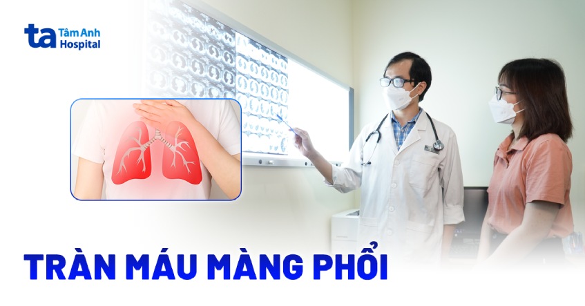 Tràn máu màng phổi: Triệu chứng, chẩn đoán và cách điều trị