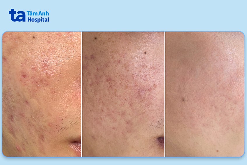 trước và sau khi bệnh nhân điều trị