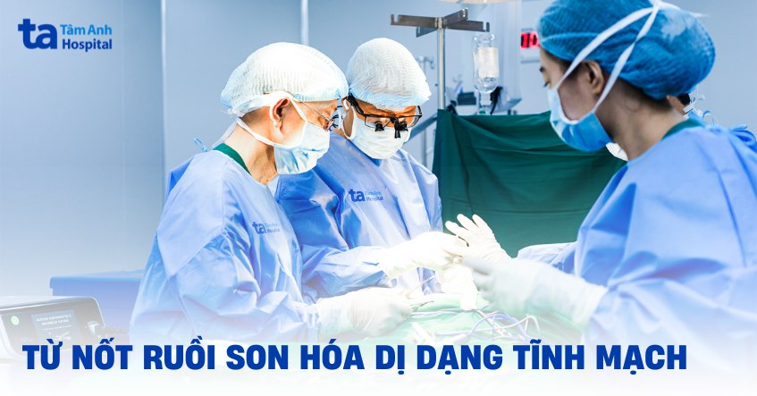 Từ nốt ruồi son hóa dị dạng tĩnh mạch