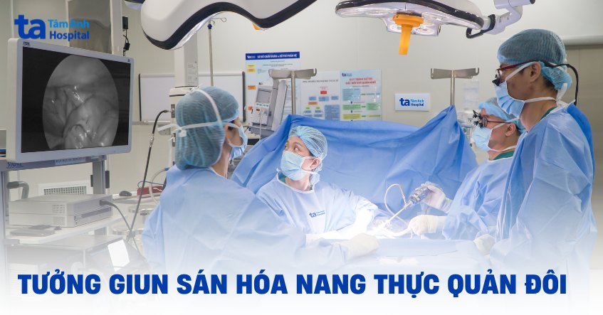 Tưởng giun sán hóa nang thực quản đôi