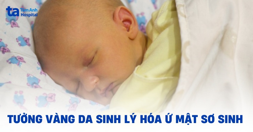 Tưởng vàng da sinh lý, hóa viêm gan sơ sinh gây ứ mật