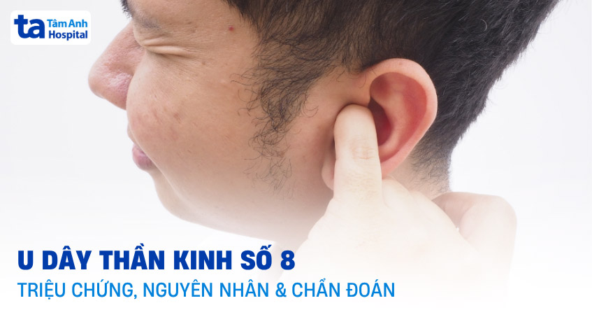 U dây thần kinh số 8: Triệu chứng, nguyên nhân và cách chẩn đoán