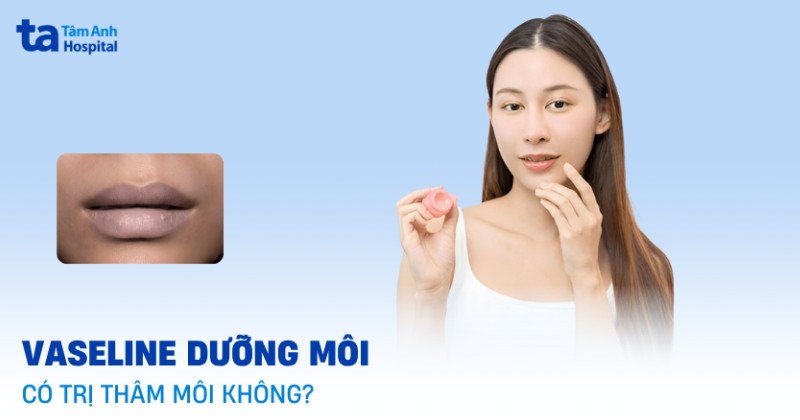 Vaseline có trị thâm môi không? 5 cách dưỡng bạn cần biết