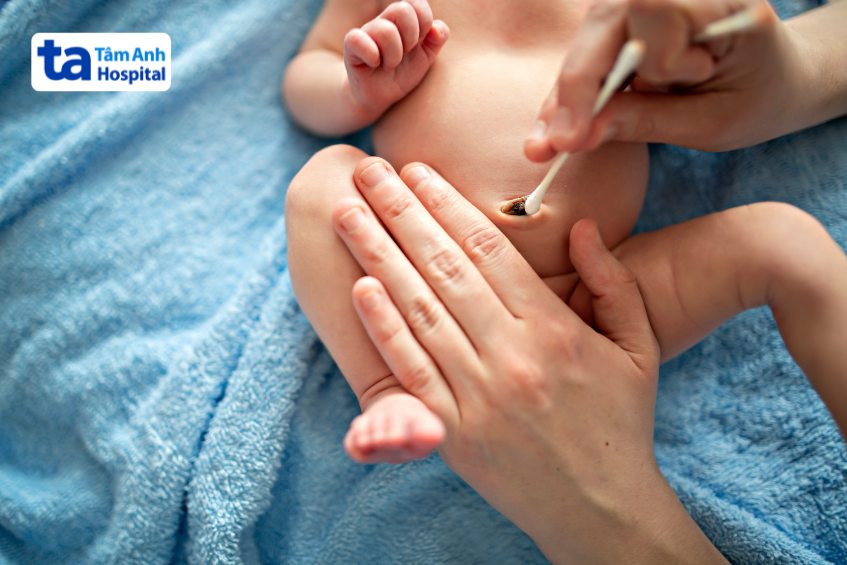 vệ sinh rốn sạch sẽ, ngăn ngừa nhiễm trùng