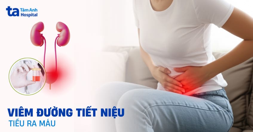 Viêm đường tiết niệu tiểu ra máu​ nguyên nhân do đâu? Có nguy hiểm không?