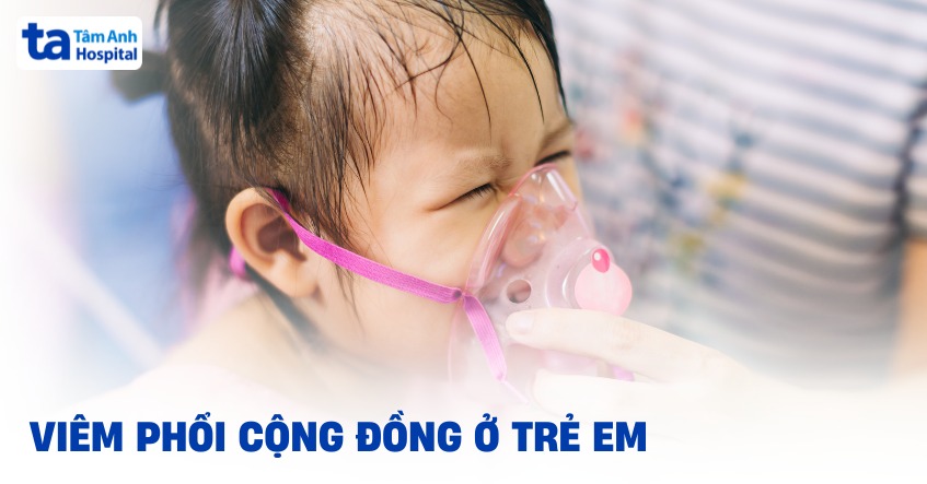 Viêm phổi cộng đồng ở trẻ em: Tác nhân gây bệnh và điều trị