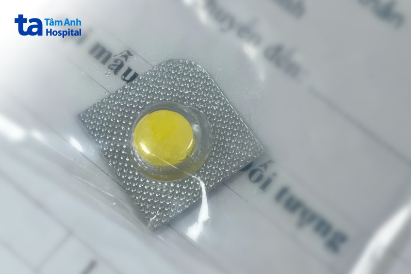 viên thuốc nghẹn ở thực quản