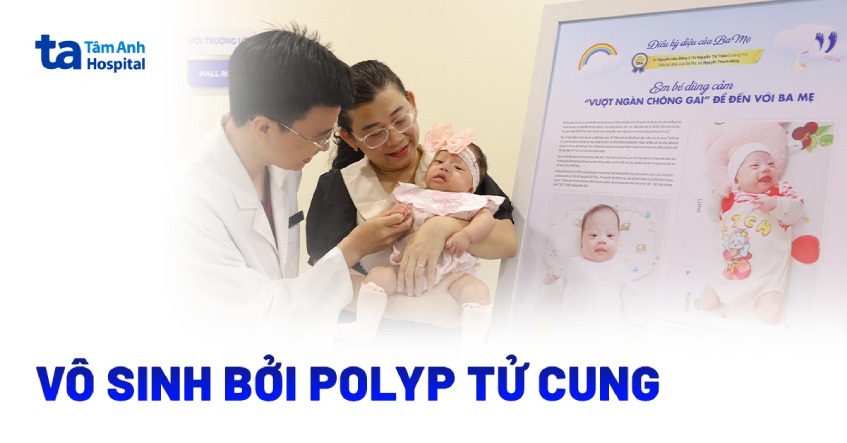 Vô sinh bởi polyp tử cung