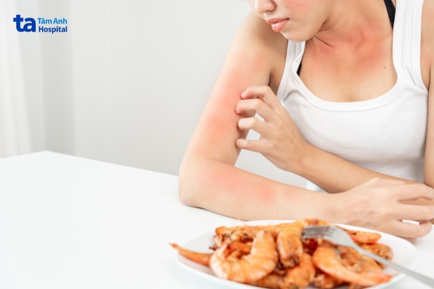 Xét nghiệm dị nguyên có thể giúp bạn phát hiện sớm