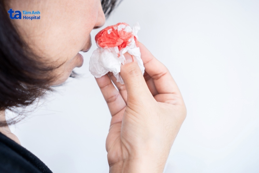xì máu mũi có thể do khối u