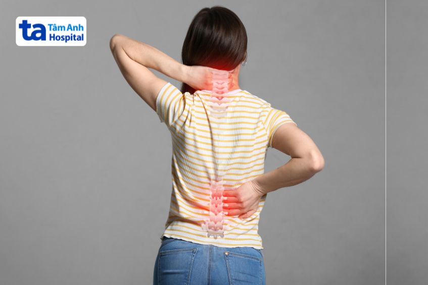 Xoay người đột ngột gây đau vùng cột sống