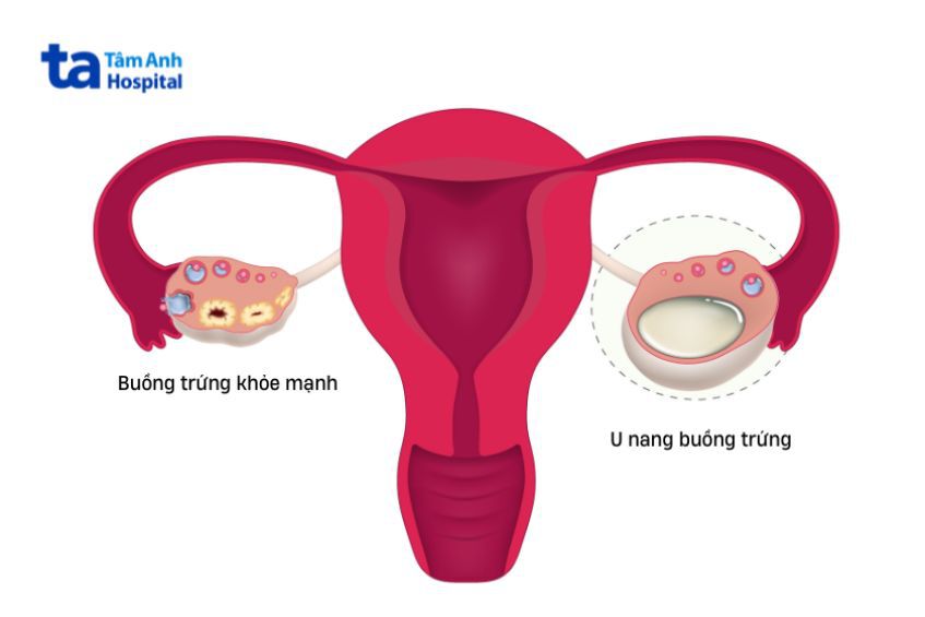 Phụ nữ mang thai và không mang thai ở nhiều độ tuổi khác nhau