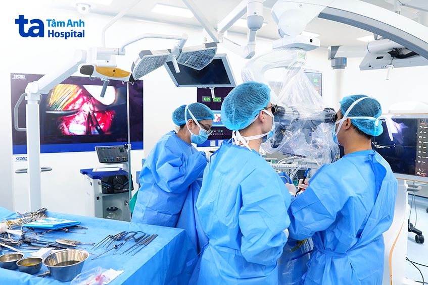 Êkíp ứng dụng hệ thống Neuro Navigation tích hợp AI phẫu thuật cho người bệnh.