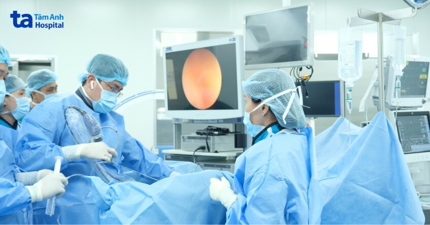 bác sĩ đạt tán sỏi qua da