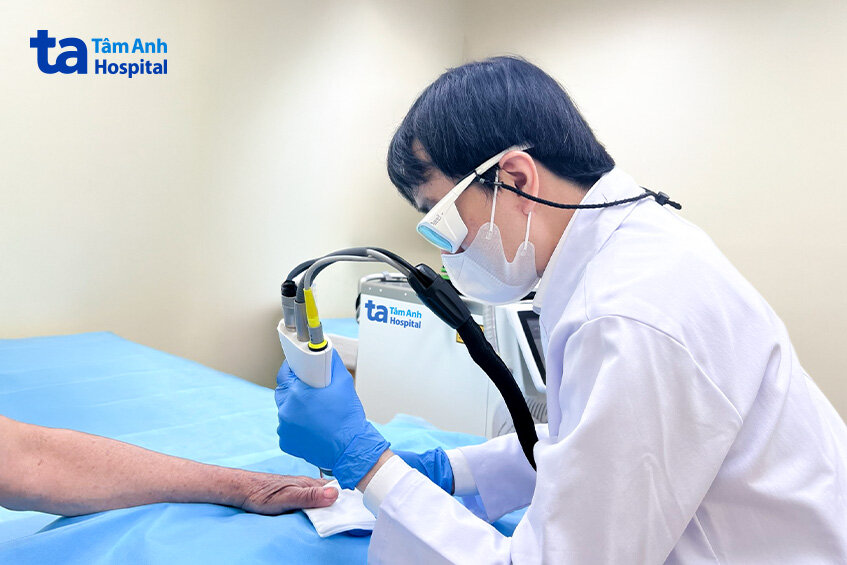 bác sĩ điều trị nấm móng cho bệnh nhân bằng laser