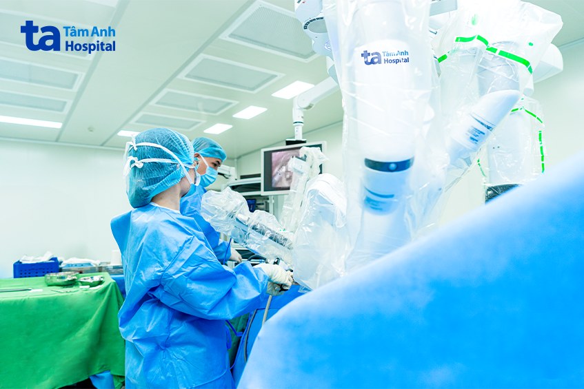 Bác sĩ phẫu thuật loại bỏ u tuyến ức cho bệnh nhân với sự hỗ trợ của robot Da Vinci Xi