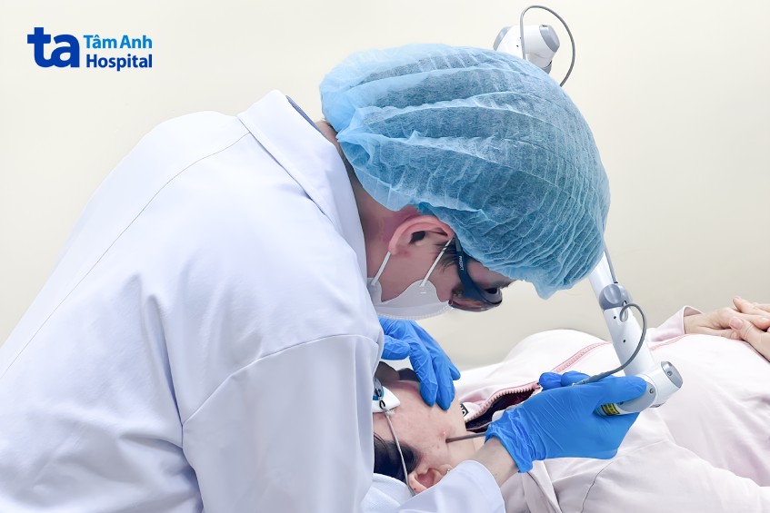 bác sĩ sử dụng laser pico điều trị đốm nâu cho chị mỹ