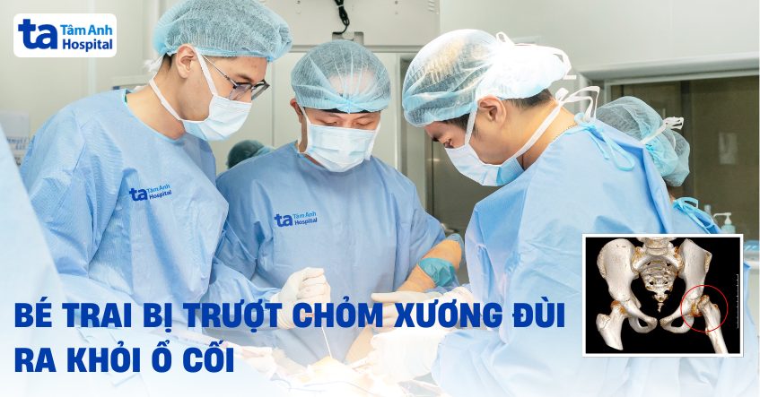 bé trai bị trượt mỏm xương đùi ra khỏi ổ cối