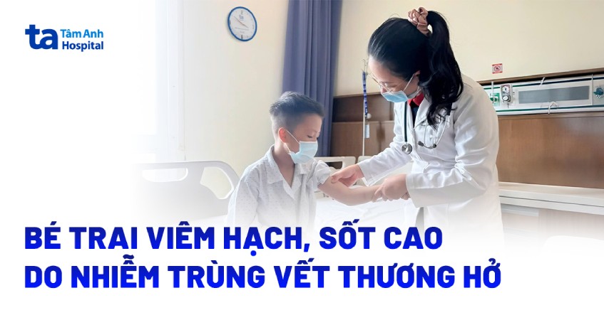 Bé trai viêm hạch, sốt cao do nhiễm trùng vết thương hở