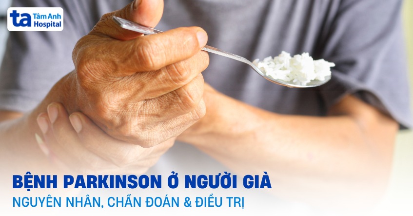 Bệnh Parkinson ở người già: Nguyên nhân, chẩn đoán, điều trị