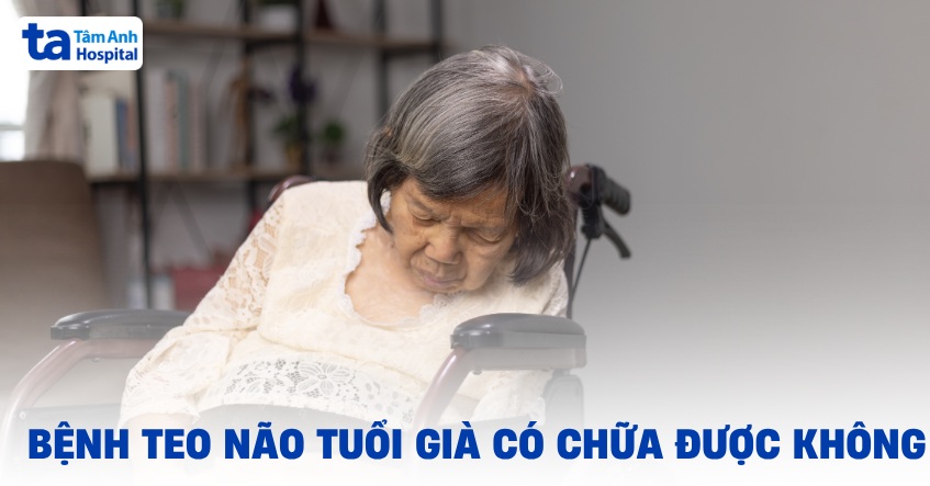Bệnh teo não tuổi già có chữa được không? Có thể đảo ngược không?