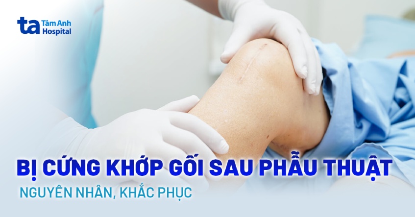Bị cứng khớp gối sau phẫu thuật thay khớp: Nguyên nhân, khắc phục