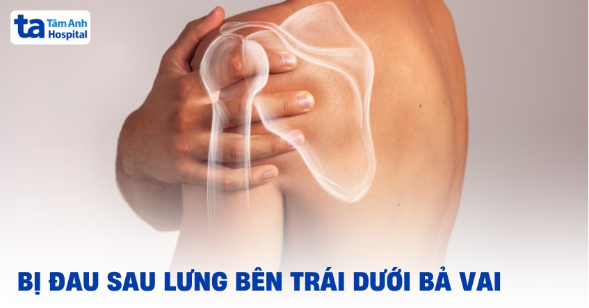 Nguyên nhân bị đau sau lưng bên trái dưới bả vai và các cách xử lý