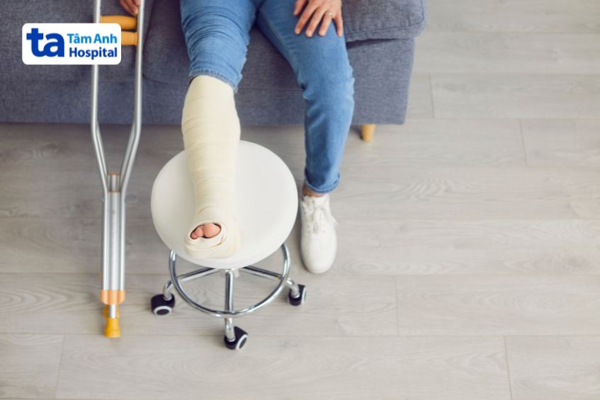 Bó bột điều trị chấn thương chân