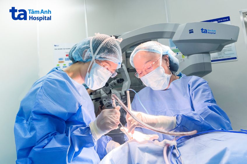 ca dùng kính vi phẫu tìm dây thần kinh số 7