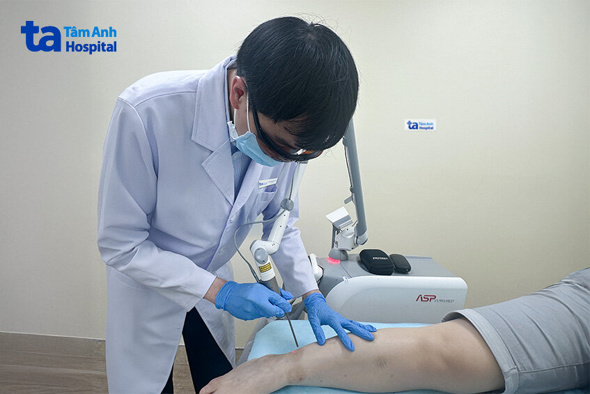 chị miên điều trị tăng sắc tố do nấm