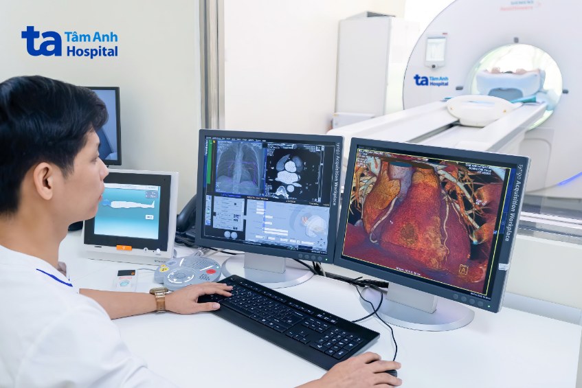 Chụp CT 100.000 lát cắt xác định chính xác vị trí, mức độ hẹp của mạch vành