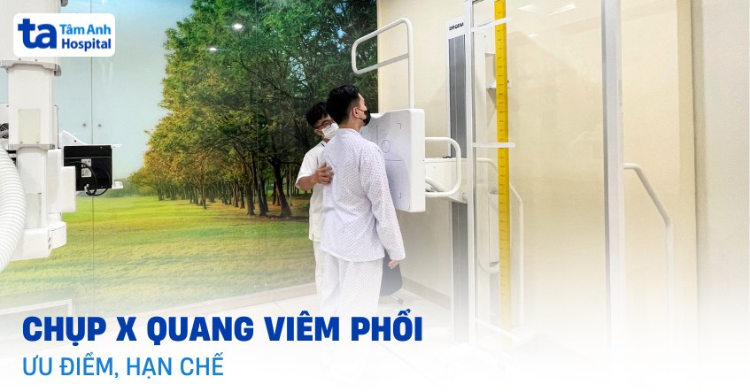 Chụp X quang viêm phổi: Quy trình, lợi ích và lưu ý khi thực hiện
