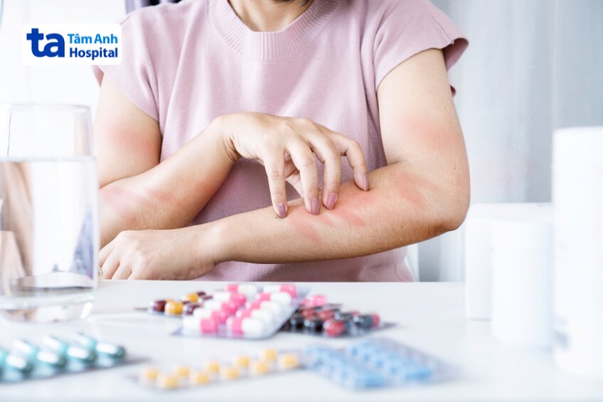 có thể gặp tình trạng ngứa và phát ban