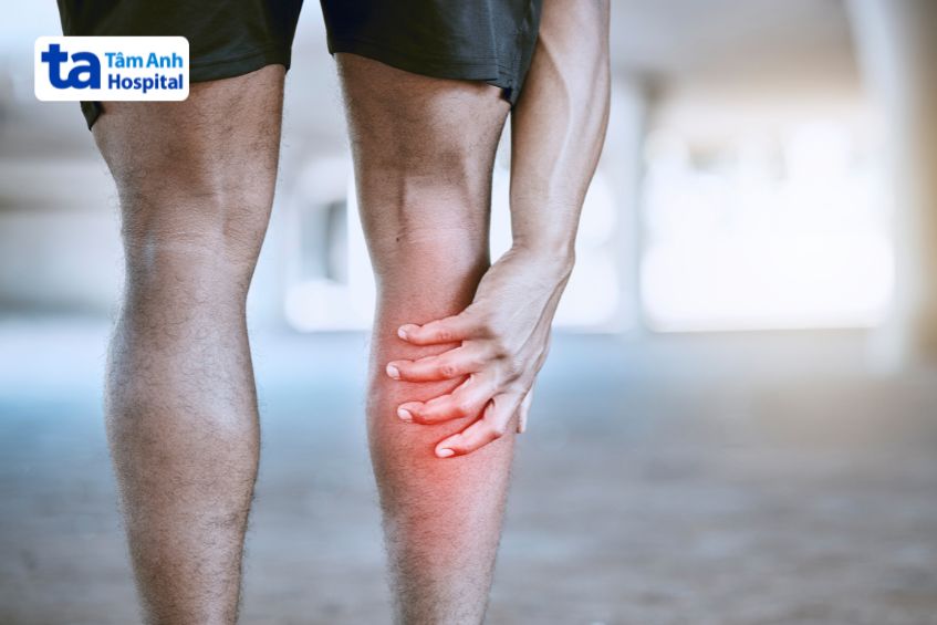 Cơn đau có thể xuất hiện ở nhiều vị trí