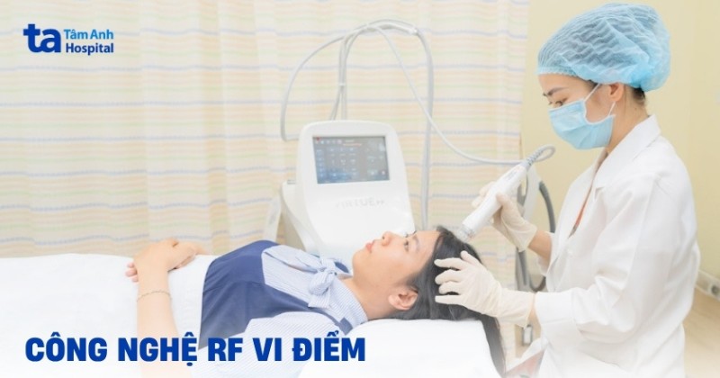 Công nghệ RF vi điểm là gì? Công dụng, ưu và nhược điểm