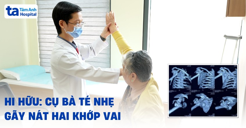 cụ bà té nhẹ gãy nát hai khớp vai