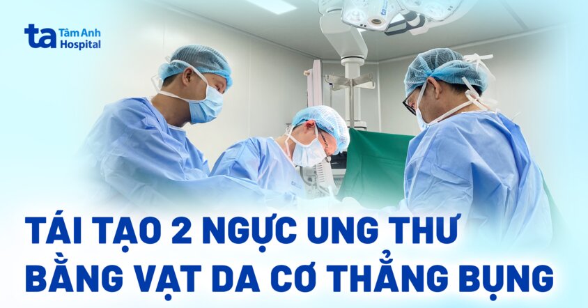 Cùng lúc tái tạo 2 ngực bằng vạt da cơ thẳng bụng cho người bệnh ung thư vú