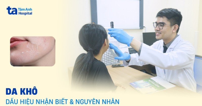 Da khô: Đặc điểm nhận biết, nguyên nhân và cách khắc phục