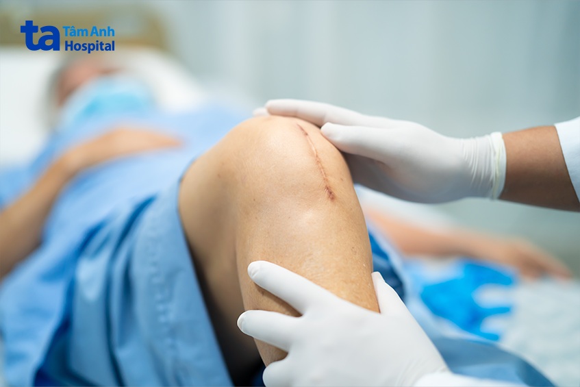 Đầu gối bị đau ở vùng thay khớp