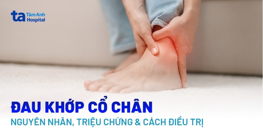 Đau khớp cổ chân nguyên nhân do đâu? Cách điều trị và phòng ngừa