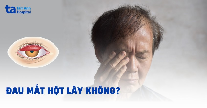 Đau mắt hột có lây không? Con đường lây lan và phòng ngừa