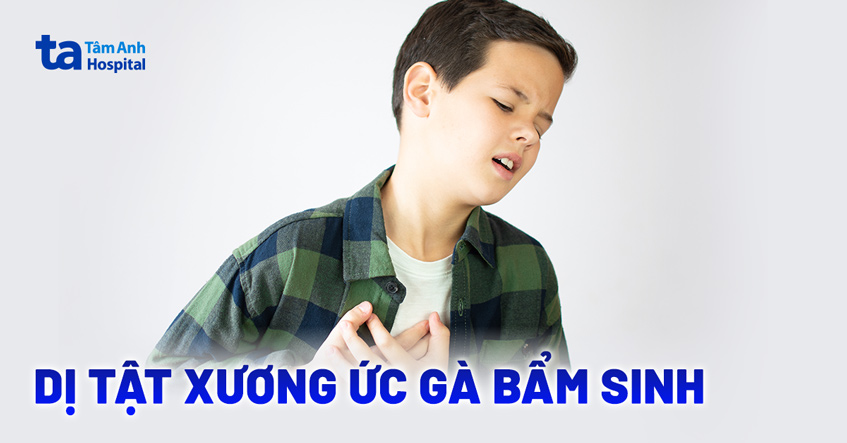 Dị tật xương ức gà (ngực lồi): Nguyên nhân, triệu chứng, điều trị