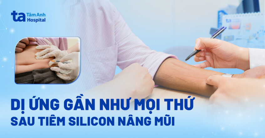 dị ứng gần như mọi thứ sau tiêm silicon nâng mũi