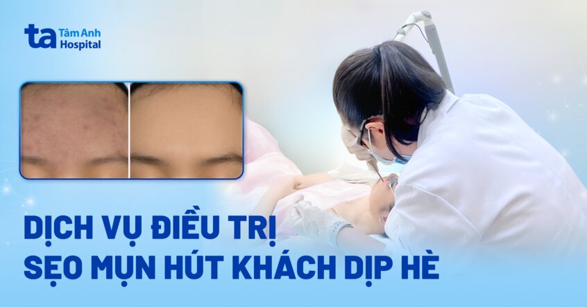 dịch vụ điều trị sẹo mụn hút khách dịp hè