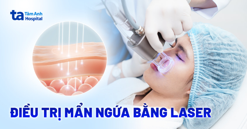 Điều trị mẩn ngứa bằng laser có hiệu quả và an toàn không?