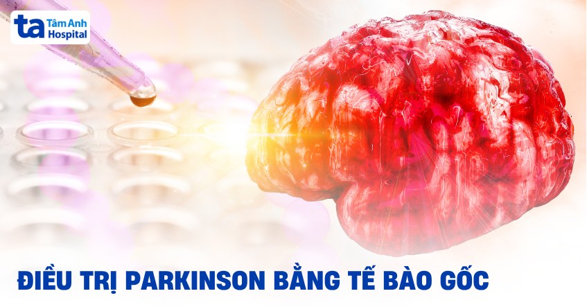 Điều trị Parkinson bằng tế bào gốc: Thông tin tham khảo cần biết