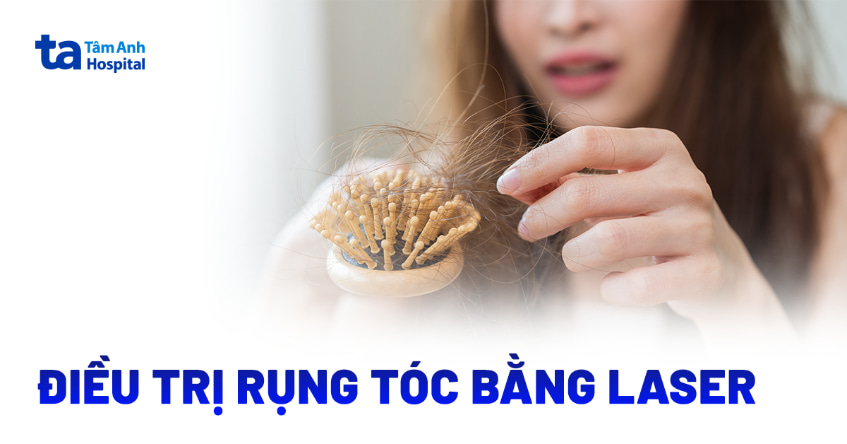 Điều trị rụng tóc bằng laser có hiệu quả thật sự không?