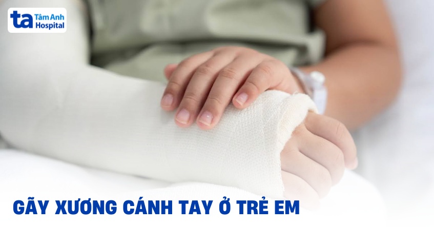 Như thế nào là gãy xương cánh tay ở trẻ em?